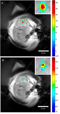 Perfluorocarbon emulsion enhances MR-ARFI displacement and temperature in vitro: Evaluating the response with MRI, NMR, and hydrophone